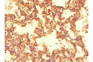 Immunohistochemistry of paraffin-embedded human lung tissue using ABIN7161902 at dilution of 1:100 (NR2C1 anticorps  (AA 1-240))