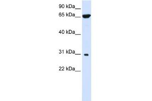 WB Suggested Anti-PTPLAD2 Antibody Titration:  0. (PTPLAD2 anticorps  (Middle Region))