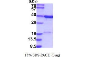 SDS-PAGE (SDS) image for Regulation of Nuclear Pre-mRNA Domain Containing 1B (RPRD1B) (AA 1-326) protein (His tag) (ABIN5854183)