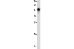 Western Blotting (WB) image for anti-Cholinergic Receptor, Nicotinic, alpha 3 (Neuronal) (CHRNA3) antibody (ABIN2431690) (CHRNA3 anticorps)