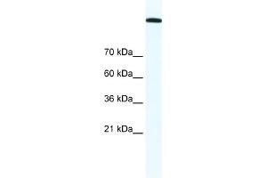 WB Suggested Anti-TOP2A Antibody Titration:  1. (Topoisomerase II alpha anticorps  (C-Term))