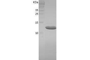 Western Blotting (WB) image for Fatty Acid Binding Protein 6, Ileal (FABP6) (AA 2-128) protein (His tag) (ABIN7122898) (FABP6 Protein (AA 2-128) (His tag))