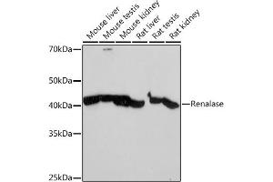 Western blot analysis of extracts of various cell lines, using Renalase Rabbit mAb (ABIN7269912) at 1:1000 dilution.