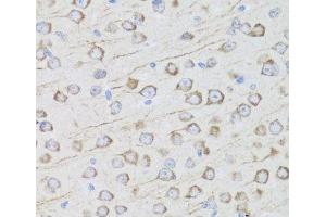 Immunohistochemistry of paraffin-embedded Mouse brain using MIP Polyclonal Antibody at dilution of 1:100 (40x lens). (Mip anticorps)