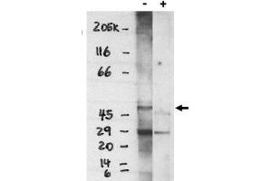 Image no. 1 for anti-Sphingosine-1-Phosphate Receptor 4 (S1PR4) (C-Term) antibody (ABIN265012) (S1PR4 anticorps  (C-Term))