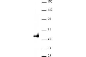 PAX6 antibody (pAb) tested by Western blot. (PAX6 anticorps  (C-Term))