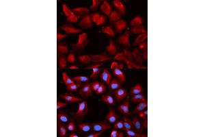 Immunofluorescence analysis of U2OS cells using DNAJB1 antibody. (DNAJB1 anticorps  (AA 1-340))