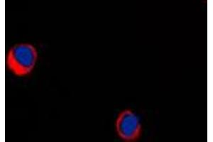 anti-Arrestin Domain Containing 1 (ARRDC1) (Center) antibody