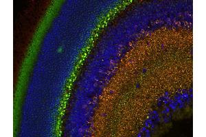 anti-Complexin 3 (CPLX3) (AA 1-158) antibody
