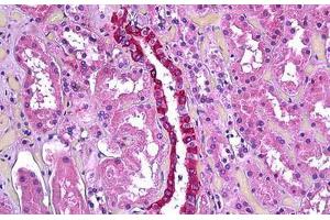 Human Kidney, Renal Duct: Formalin-Fixed, Paraffin-Embedded (FFPE) (TGFBI anticorps  (AA 119-131))