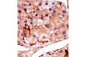 Image no. 1 for anti-6-phosphofructo-2-Kinase/fructose-2,6-Biphosphatase 2 (PFKFB2) (N-Term) antibody (ABIN360654)