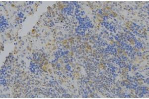 ABIN6276400 at 1/100 staining Human lymph node tissue by IHC-P. (ATG7 anticorps  (N-Term))