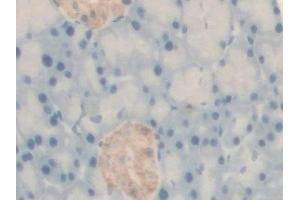 Detection of BCKDK in Rat Pancreas Tissue using Polyclonal Antibody to Branched Chain Alpha-Ketoacid Dehydrogenase Kinase (BCKDK) (BCKDK anticorps  (AA 44-223))