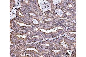IHC analysis of RPL36 using anti-RPL36 antibody (ABIN7602917). (RPL36 anticorps  (C-Term))