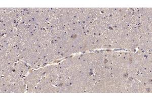 Detection of RELN in Human Cerebrum Tissue using Monoclonal Antibody to Reelin (RELN)