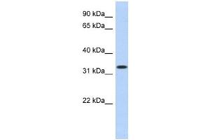 MPPED2 antibody used at 1 ug/ml to detect target protein. (MPPED2 anticorps  (N-Term))