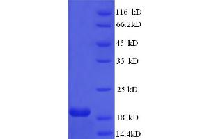 SDS-PAGE (SDS) image for Human Papilloma Virus 16 E7 (HPV-16 E7) (AA 1-105), (full length) protein (His tag) (ABIN5711077)