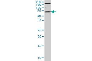 UCKL1 monoclonal antibody (M01), clone 8D4 Western Blot analysis of UCKL1 expression in NIH/3T3 . (UCKL1 anticorps  (AA 301-400))