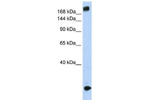 WB Suggested Anti-SCN5A Antibody Titration:  0. (SCN5A anticorps  (N-Term))