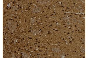 ABIN6276787 at 1/100 staining Rat brain tissue by IHC-P. (CTNND1 anticorps)