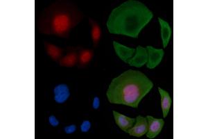 ABIN6255629 and ABIN6267394 staining Hela cells(30 min of UV treatment) by IF/ICC. (RPA2 anticorps  (pThr21))