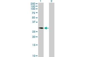 Western Blot analysis of C1GALT1C1 expression in transfected 293T cell line by C1GALT1C1 MaxPab polyclonal antibody. (C1GALT1C1 anticorps  (AA 1-318))