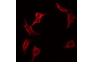 ABIN6266850 staining A549 by IF/ICC. (ADCK1 anticorps  (Internal Region))