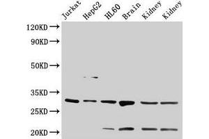 Western Blot Positive WB detected in: Jurkat whole cell lysate, HepG2 whole cell lysate, HL60 whole cell lysate, Rat brain tissue, Rat kidney tissue, Mouse kidney tissue All lanes: YWHAB antibody at 4 μg/mL Secondary Goat polyclonal to rabbit IgG at 1/50000 dilution Predicted band size: 29, 28 kDa Observed band size: 29 kDa (YWHAB anticorps  (AA 1-246))