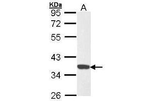 WB Image Sample (30 ug of whole cell lysate) A: Hela 10% SDS PAGE antibody diluted at 1:1000 (CDK6 anticorps)