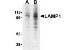 AP20059PU-N CD107a/LAMP1 antibody staining of EL4 cell lysate by Western Blotting at (A) 1 and (B) 2 μg/ml. (LAMP1 anticorps)