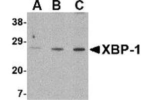 Western Blotting (WB) image for anti-X-Box Binding Protein 1 (XBP1) (C-Term) antibody (ABIN1030805) (XBP1 anticorps  (C-Term))