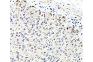 Immunohistochemistry of paraffin-embedded Mouse stomach using CNOT8 Polyclonal Antibody at dilution of 1:100 (40x lens).