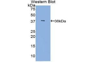 Western Blotting (WB) image for anti-Mannose-Binding Lectin (Protein C) 2, Soluble (MBL2) (AA 42-96) antibody (ABIN3206582) (MBL2 anticorps  (AA 42-96))
