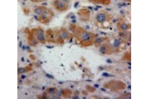 IHC-P analysis of Liver tissue, with DAB staining. (Fibrinogen beta Chain anticorps  (AA 33-479))