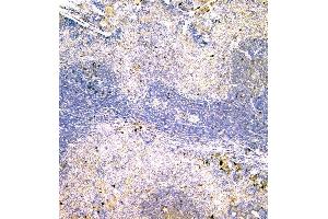 IHC analysis of IGLL1 using anti-IGLL1 antibody (ABIN6719329). (IGLL1 anticorps)