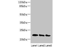 Western blot All lanes: ARL8B antibody at 4 μg/mL Lane 1: Mouse brain tissue Lane 2: NIH/3T3 whole cell lysate Lane 3: Jurkat whole cell lysate Secondary Goat polyclonal to rabbit IgG at 1/10000 dilution Predicted band size: 22, 19 kDa Observed band size: 22 kDa (ARL8B anticorps  (AA 20-186))