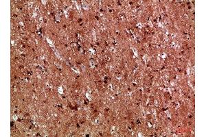 Immunohistochemical analysis of paraffin-embedded Human-brain, antibody was diluted at 1:100 (IL17D anticorps  (AA 141-190))