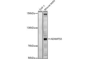Western blot analysis of extracts of various cell lines, using  antibody (ABIN3016805, ABIN3016806, ABIN3016807 and ABIN6219845) at 1:500 dilution. (ADAMTS5 anticorps  (AA 731-930))