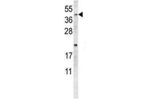 Western blot analysis of NEU1 antibody and MDA-MB231 lysate. (NEU1 anticorps  (AA 11-40))