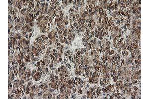 Image no. 3 for anti-Excision Repair Cross-Complementing Rodent Repair Deficiency, Complementation Group 4 (ERCC4) antibody (ABIN1498070)