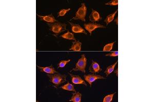 Immunofluorescence analysis of L929 cells using ZCCHC11 Rabbit pAb (ABIN6128939, ABIN6150406, ABIN6150407 and ABIN6221650) at dilution of 1:100. (ZCCHC11 anticorps  (AA 1-290))