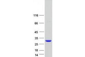 Validation with Western Blot
