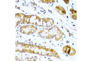Immunohistochemistry of paraffin-embedded human stomach using GCG antibody (ABIN5970469) at dilution of 1/100 (40x lens). (Glucagon anticorps)