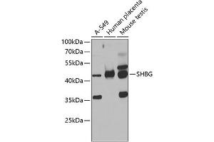 Western blot analysis of extracts of various cell lines, using SHBG antibody (ABIN6129327, ABIN6147736, ABIN6147737 and ABIN6223329) at 1:1000 dilution.