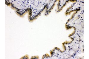 Anti- RAGE Picoband antibody, IHC(P) IHC(P): Rat Lung Tissue
