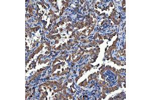 IHC analysis of SDF2L1 using anti-SDF2L1 antibody (ABIN7601111). (SDF2L1 anticorps  (AA 29-221))
