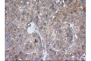 Immunohistochemical staining of paraffin-embedded Human liver tissue using anti-PDE4A mouse monoclonal antibody. (PDE4A anticorps)