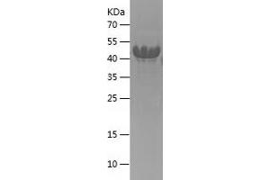 Western Blotting (WB) image for Cyclin-Dependent Kinase Inhibitor 1C (p57, Kip2) (CDKN1C) (AA 34-316) protein (His tag) (ABIN7122539)