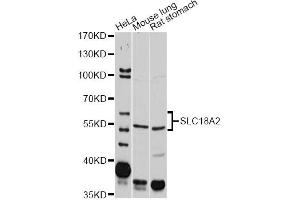 Western blot analysis of extracts of various cell lines, using SLC18A2 antibody (ABIN5971480) at 1/2000 dilution. (SLC18A2 anticorps)