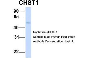 Host: Rabbit Target Name: CHST1 Sample Type: Human Fetal Heart Antibody Dilution: 1. (CHST1 anticorps  (Middle Region))
